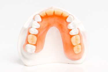 fdi_flexprothese-2